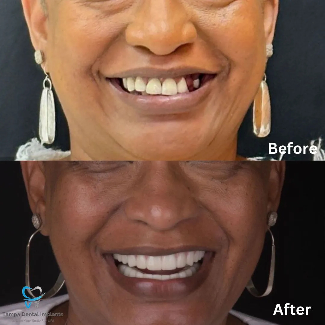 befor-after image