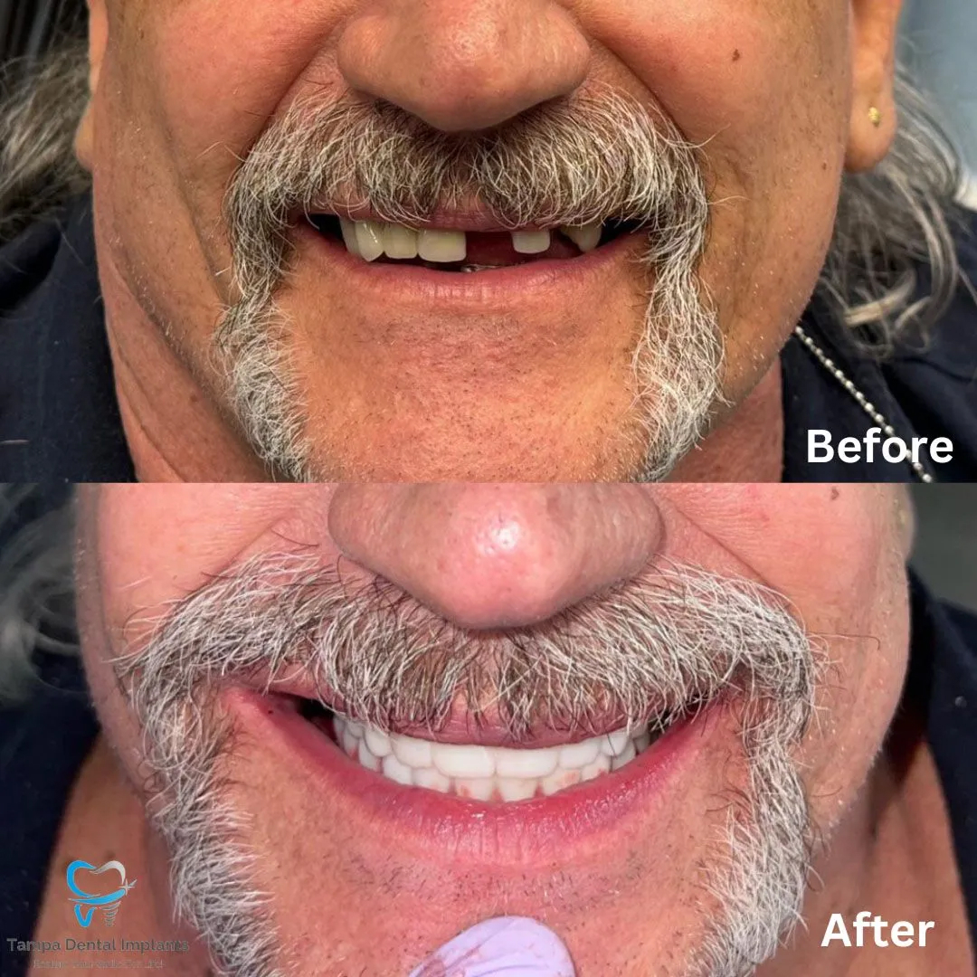 befor-after image